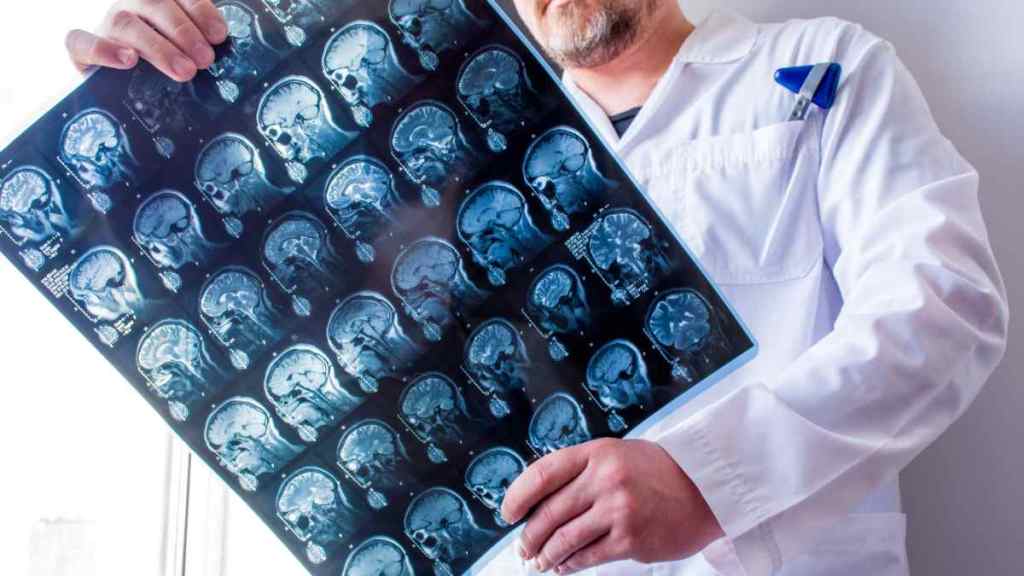 Estudio revela que la depresión en los afectados por esclerosis múltiple es cuatro veces superior a la de la población&nbsp;general